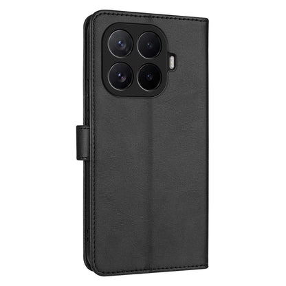 For Xiaomi 17T 5G AZNS Skin Feel Calf Texture Flip Leather Phone Case(Black)