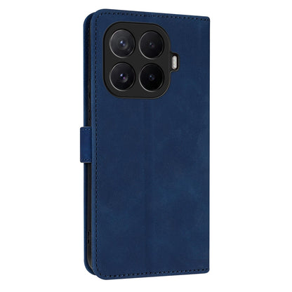 For Xiaomi 17T Pro 5G AZNS Skin Feel Calf Texture Flip Leather Phone Case(Blue)