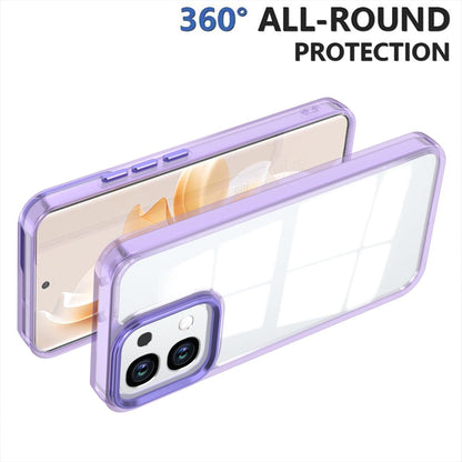 For OPPO A6 Pro 5G Shine High Transparency Acrylic Phone Case - Purple - EDA006326702A