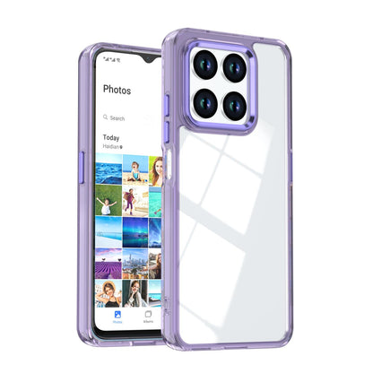 For Honor 400 Smart / X7d 5G Shine High Transparency Acrylic Phone Case - Purple - EDA007376004A