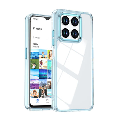 For Honor 400 Smart / X7d 5G Shine High Transparency Acrylic Phone Case - Blue - EDA007376004C