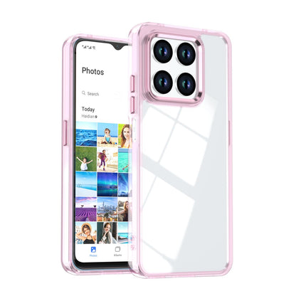 For Honor 400 Smart / X7d 5G Shine High Transparency Acrylic Phone Case - Pink - EDA007376004D