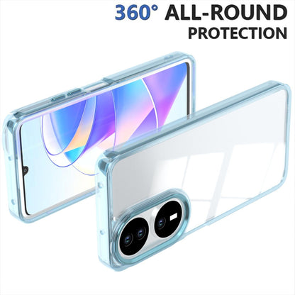 For Honor X7b / Play 50 Plus Shine High Transparency Acrylic Phone Case - Blue - EDA007376010C