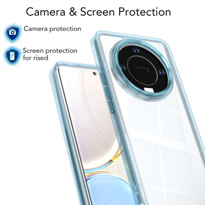 For Honor X9b / X50 / Magic6 Lite Shine High Transparency Acrylic Phone Case - Blue - EDA007376015C
