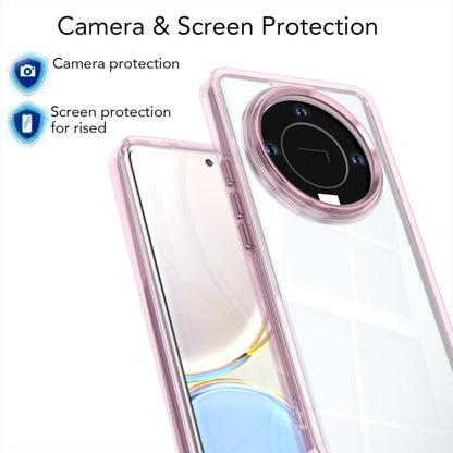 For Honor X9b / X50 / Magic6 Lite Shine High Transparency Acrylic Phone Case - Pink - EDA007376015D